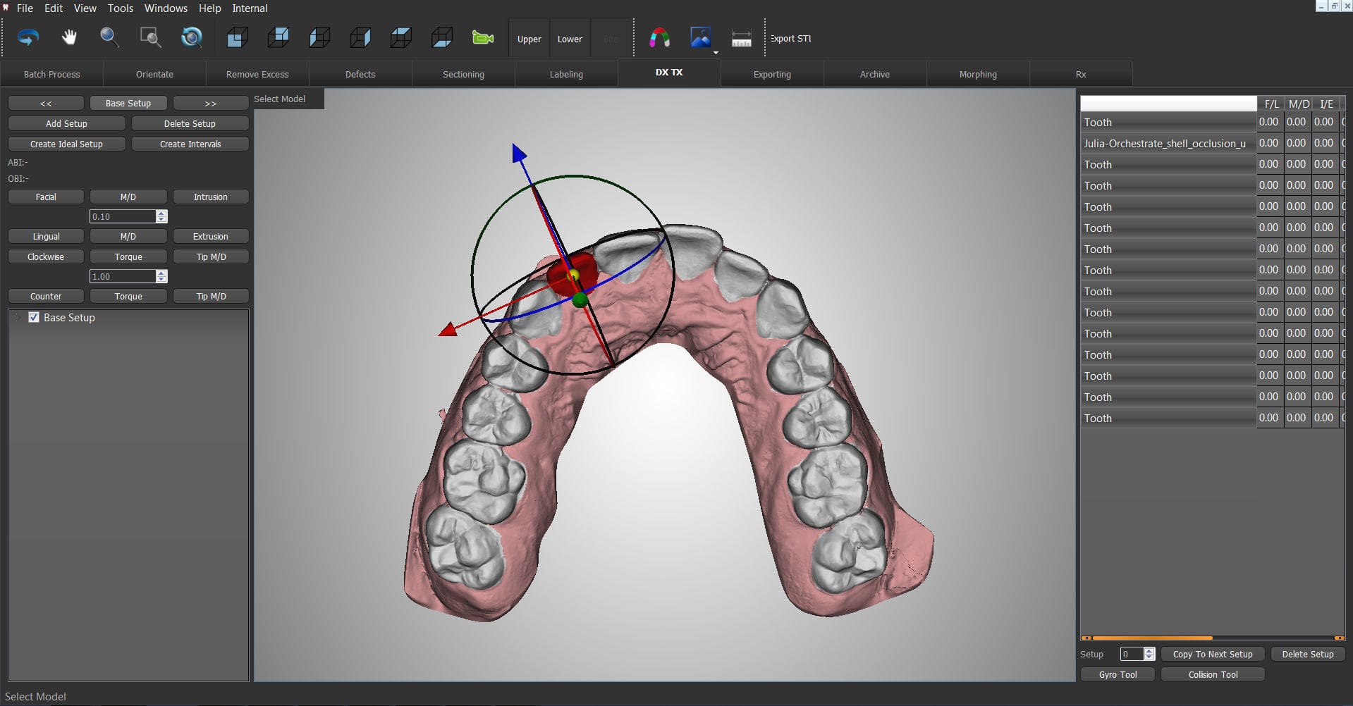 Orthodontic Software: What Is It Used For?